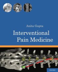 bokomslag Interventional Pain Medicine