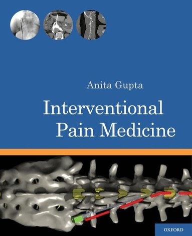 Anita Gupta - Interventional Pain Medicine, Häftad