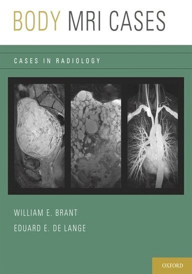 Eduard E. de Lange, William E. Brant - Body MRI Cases, Häftad
