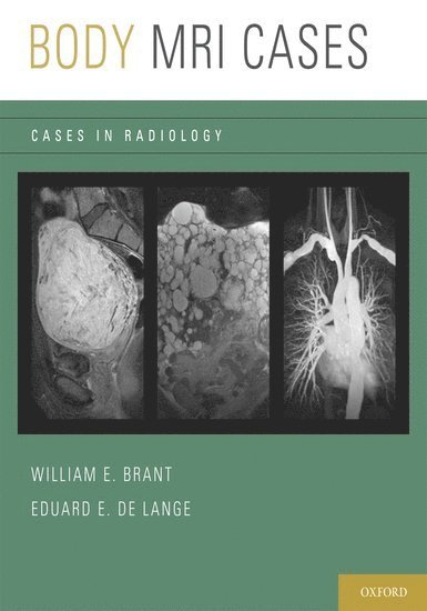 Eduard E. de Lange, USA) de Lange, Eduard E. (Professor of Radiology, Professor of Radiology, University of Virginia, Charlottesville, VA, BRANT, William E. Brant, USA) Brant, William E. (Professor of Radiology, Professor of Radiology, University of Virginia, Charlottesville, VA, Eduard E. De Lange, William E Brant, Eduard E de Lange - Body MRI Cases, Häftad