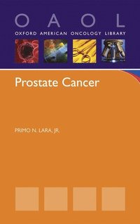 bokomslag Prostate Cancer