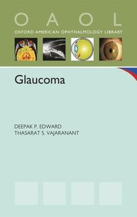 bokomslag Glaucoma