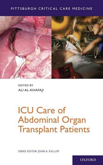 Ali Al-Khafaji, Ali Al-Khafaji - ICU Care of Abdominal Organ Transplant Patients, Häftad