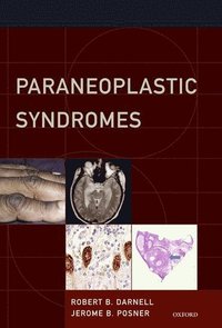 bokomslag Paraneoplastic Syndromes
