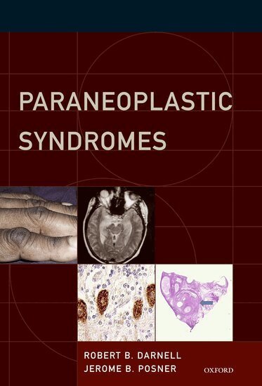 Robert B. Darnell, Jerome B. Posner - Paraneoplastic Syndromes, Inbunden