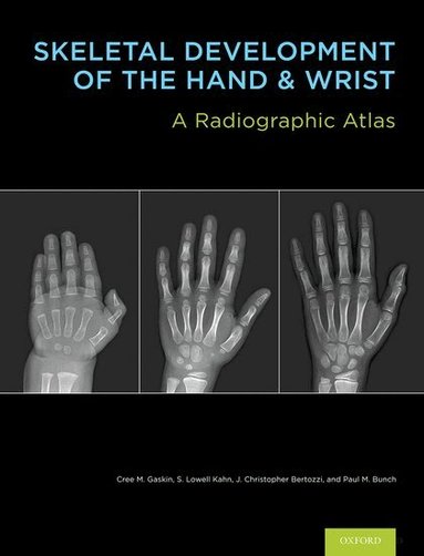 Cree M. Gaskin, S. Lowell Kahn, J. Christoper Bertozzi, Paul M. Bunch - Skeletal Development of the Hand and Wrist, Inbunden