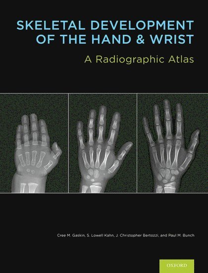 Skeletal Development of the Hand and Wrist 1