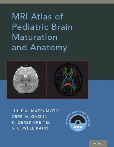 Julie A. Matsumoto, Cree M. Gaskin, Derek Kreitel, S. Lowell Kahn - MRI Atlas of Pediatric Brain Maturation and Anatomy, Inbunden