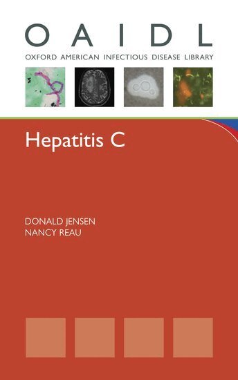 Donald Jensen, Nancy Reau - Hepatitis C, Häftad