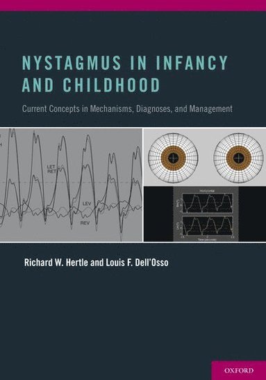 bokomslag Nystagmus In Infancy and Childhood