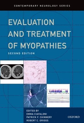 Emma Ciafaloni, Patrick Chinnery, Emma Ciafaloni, Patrick F. Chinnery, Robert C. Griggs - Evaluation and Treatment of Myopathies, Inbunden