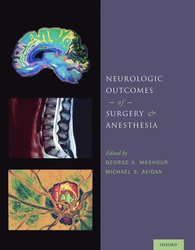 bokomslag Neurologic Outcomes of Surgery and Anesthesia