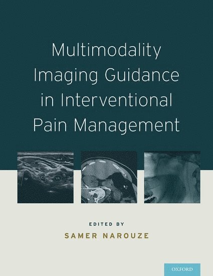 Samer N. Narouze, Ohio) Narouze, Samer N. (Chairman, Center for Pain Medicine, Chairman, Center for Pain Medicine, Summa Western Reserve Hospital, Cuyahoga Falls, Samer N Narouze - Multimodality Imaging Guidance in Interventional Pain Management, Inbunden