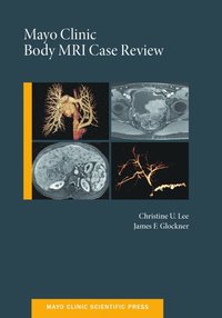 bokomslag Mayo Clinic Body MRI Case Review