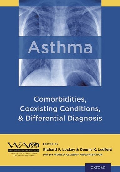 WAO, Richard F. Lockey, Dennis K. Ledford - Asthma, Inbunden