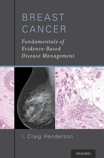 I. Craig Henderson - Breast Cancer, Häftad