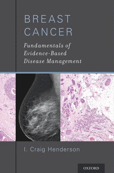 I. Craig Henderson, University of California San Francisco) Henderson, I. Craig (Professor of Medicine, Professor of Medicine, I Craig Henderson - Breast Cancer, Häftad