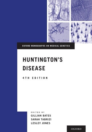 BATES, Gillian Bates, Sarah Tabrizi, Lesley Jones - Huntington's Disease, Inbunden