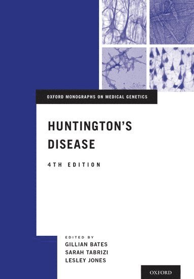 bokomslag Huntington's Disease