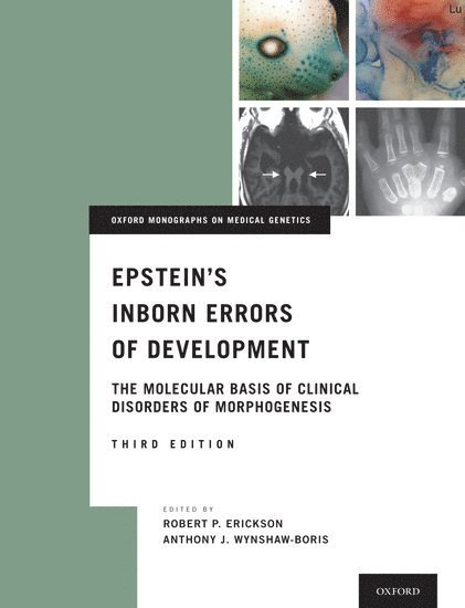 Robert P. Erickson, Anthony J. Wynshaw-Boris - Epstein's Inborn Errors of Development, Inbunden