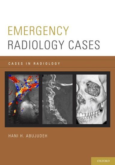 Hani H. Abujudeh, Hani H. Abujudeh - Emergency Radiology Cases, Häftad