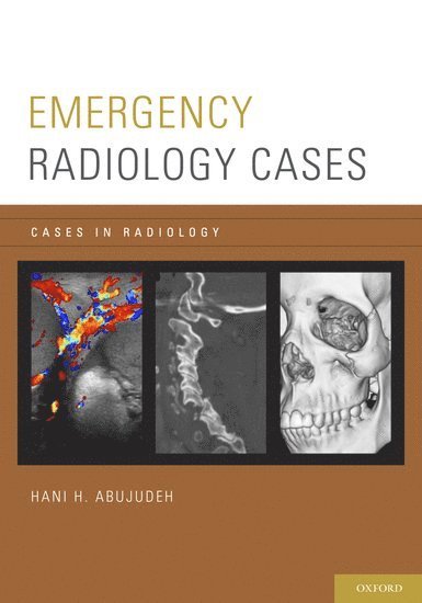 Hani H. Abujudeh, Hani H. Abujudeh, Massachusetts) Abujudeh, Hani H. (Associate Professor of Radiology, Associate Professor of Radiology, Harvard Medical School, Massachusetts General Hospital, Boston, Hani H Abujudeh - Emergency Radiology Cases, Häftad
