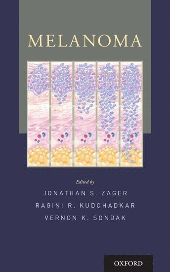Zager, ZAGER, Jonathan S. Zager, Ragini Kudchadkar, Vernon K. Sondak, H. Lee Moffitt Cancer Center) Zager, Jonathan S. (Director of Regional Therapies, Department of Cutaneous Oncology, Director of Regional Therapies, Department of Cutaneous Oncology, Winship Cancer Institute at Emory University) Kudchadkar, Ragini, MD (Assistant Professor of Hematology/Oncology, Assistant Professor of Hematology/Oncology, H. Lee Moffitt Cancer Center) Sondak, Vernon K. (Chair, Department of Cutaneous Oncology; Director of Surgical Education, Chair, Department of Cutaneous Oncology; Director of Surgical Education - Melanoma, Häftad