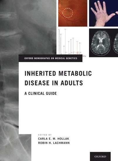 Inherited Metabolic Disease in Adults 1