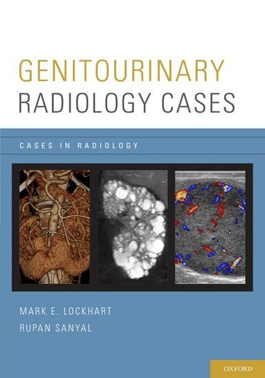 Lockhart, Mark E. Lockhart, Rupan Sanyal - Genitourinary Radiology Cases, Häftad