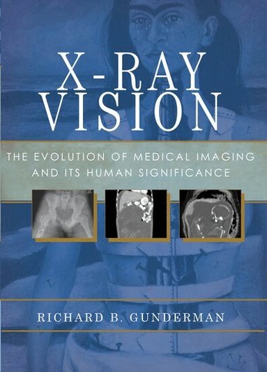 Richard B. Gunderman - X-Ray Vision, Häftad