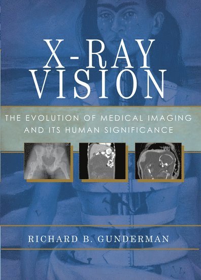 X-Ray Vision 1