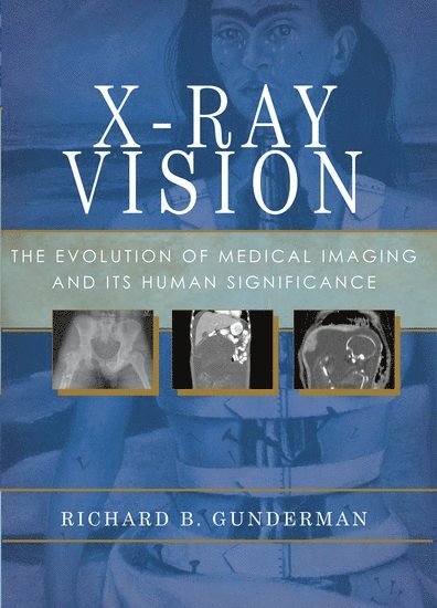 X-Ray Vision