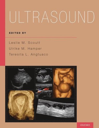 bokomslag Ultrasound