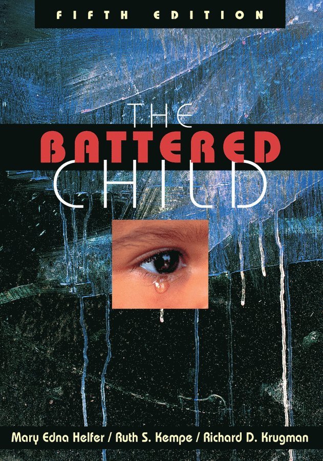 Mary Edna Helfer, Ruth S. Kempe, Richard D. Krugman - Battered Child, Häftad