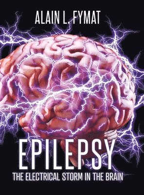 bokomslag Epilepsy