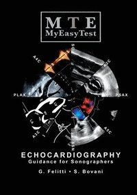 bokomslag Echocardiography - MyEasyTest