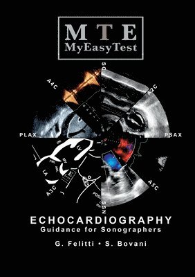 bokomslag Echocardiography - MyEasyTest