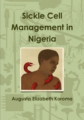 bokomslag Sickle Cell Management in Nigeria