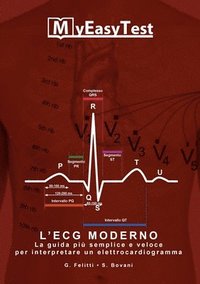 bokomslag L'ECG Moderno - MyEasyTest (edizione economica)