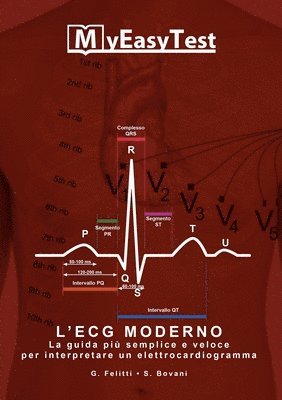 L'ECG Moderno - MyEasyTest (edizione economica) 1