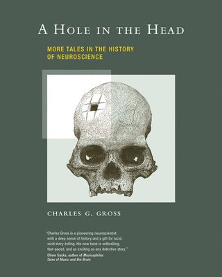 bokomslag Hole in the Head