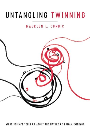 Maureen L. Condic - Untangling Twinning, Inbunden