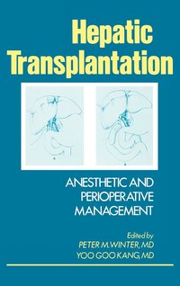 bokomslag Hepatic Transplantation