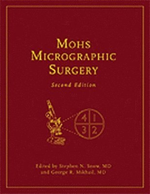 Mohs Micrographic Surgery