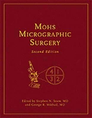 Mohs Micrographic Surgery 1