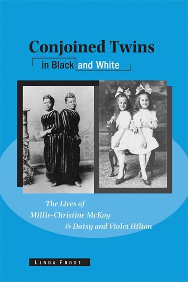 William L. Andrews, Linda Frost - Conjoined Twins in Black and White, Häftad