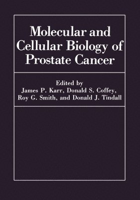 Symposium on Molecular and Cellular Biol, James P. Karr, etc. - Molecular and Cellular Biology Prostate Cancer, Inbunden