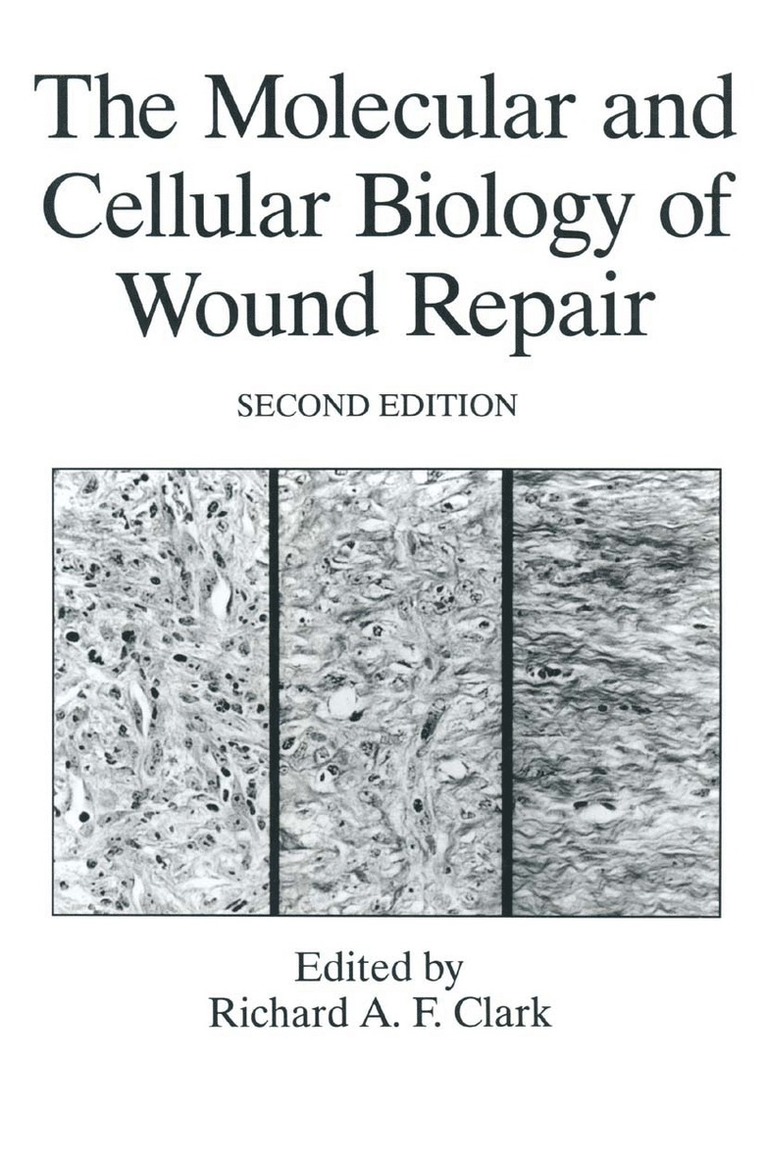 The Molecular and Cellular Biology of Wound Repair 1