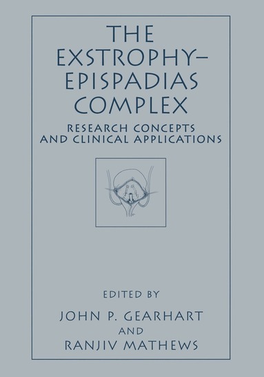 John P. Gearhart, Ranjiv Mathews - Exstrophy—Epispadias Complex, Inbunden