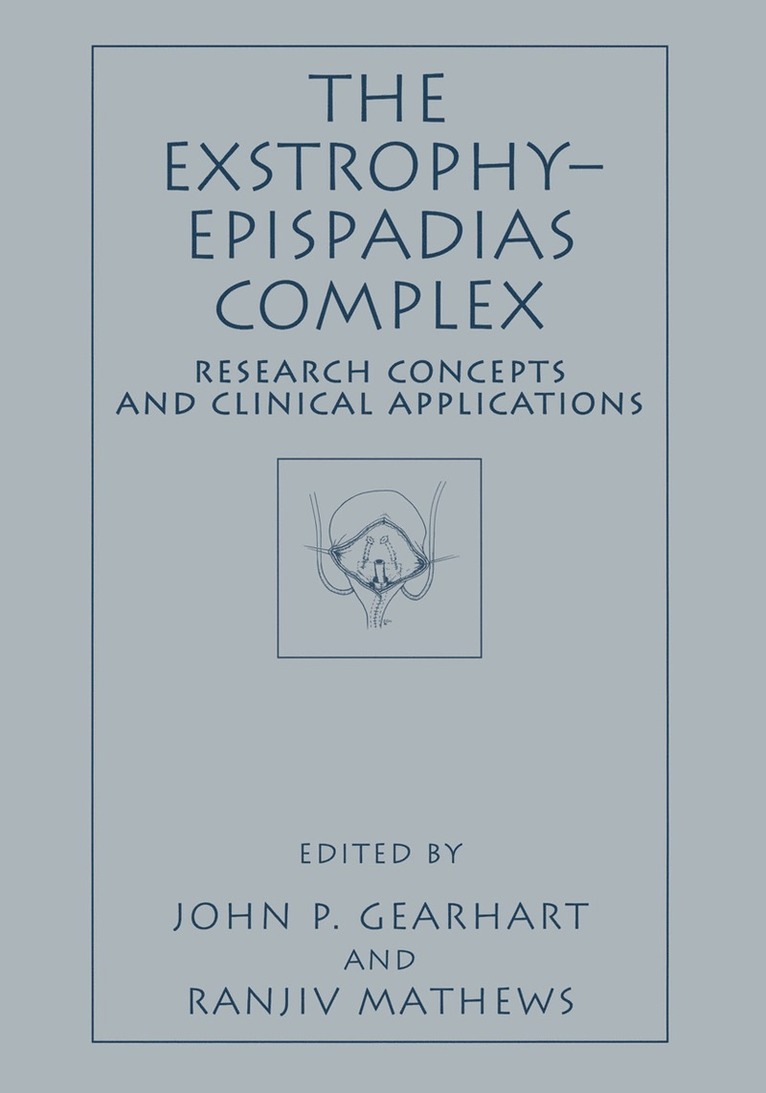 Exstrophy—Epispadias Complex